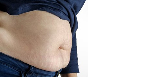Παχυσαρκία: Ο αμερικανικός FDA ενέκρινε τη σεμαγλουτίδη για τη θεραπεία της σε εφήβους 12 ετών και άνω