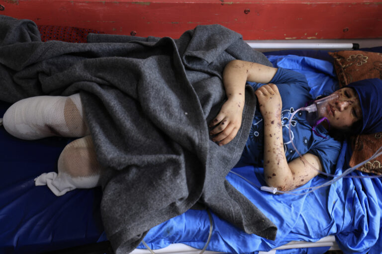 Συγκλονίζουν τα ακρωτηριασμένα παιδιά στην εμπόλεμη Γάζα – «Πού είναι το πόδι μου;» ουρλιάζει η Λαγιάν αλ Μπαζ